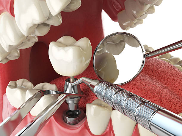 Best Cosmetic Emergency Dentistry in March Ar, CA