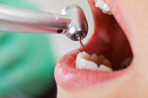 Reliable CA Emergency Dentist Solutions